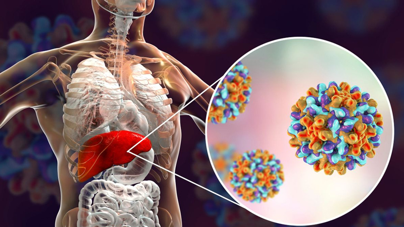 Bahaya Penyakit Hepatitis, Kenali Jenis dan Cara Penularannya – PAFI Kabupaten Buol